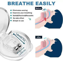 Load image into Gallery viewer, Anti Snoring Nose Clip Device for Men Women
